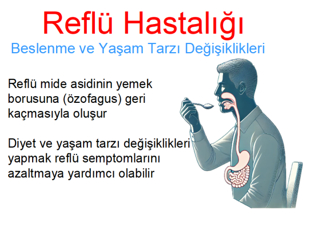 Reflü hastalığı diyet