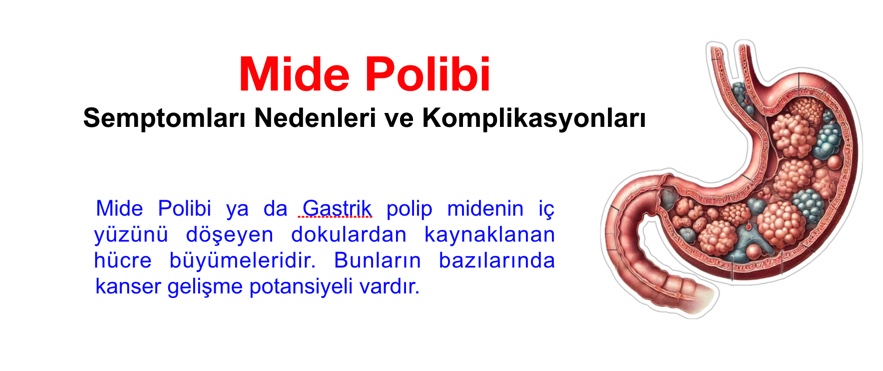 Mide polibi