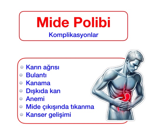 Mide polibi belirtileri