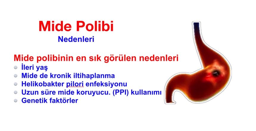 Mide polibi nedenleri